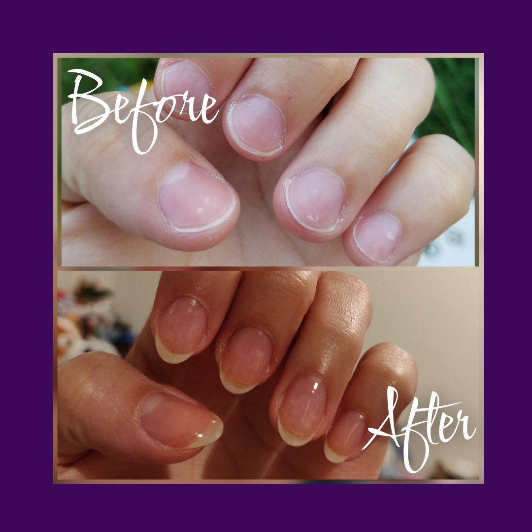 Nail Growth Oil By Shen Nail